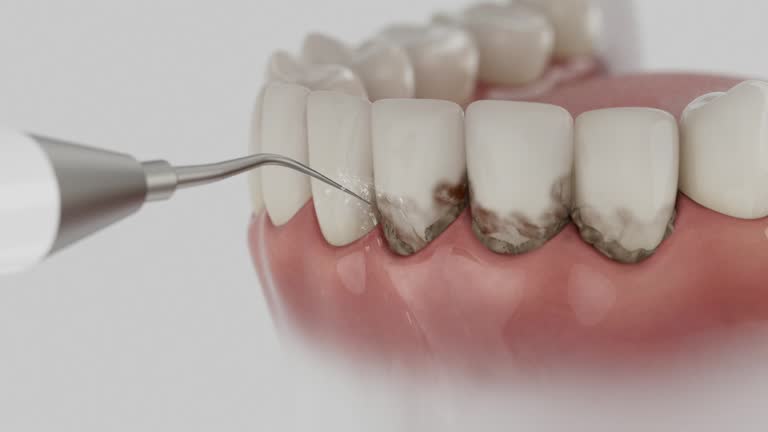 Reliable Emergency Dentist contractor in Brigantine, NJ by Smile Center Dentistry